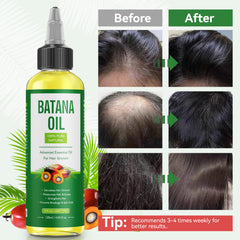 Batana Oil for Hair Care | Unrefined Honduran Oil for Dry Hair, Scalp & Hair Repair, 4.05 oz
