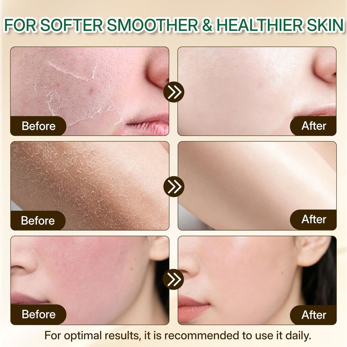 Whipped Beef Tallow Cream, Unscented Face and Body Moisturizer, 3.5 oz