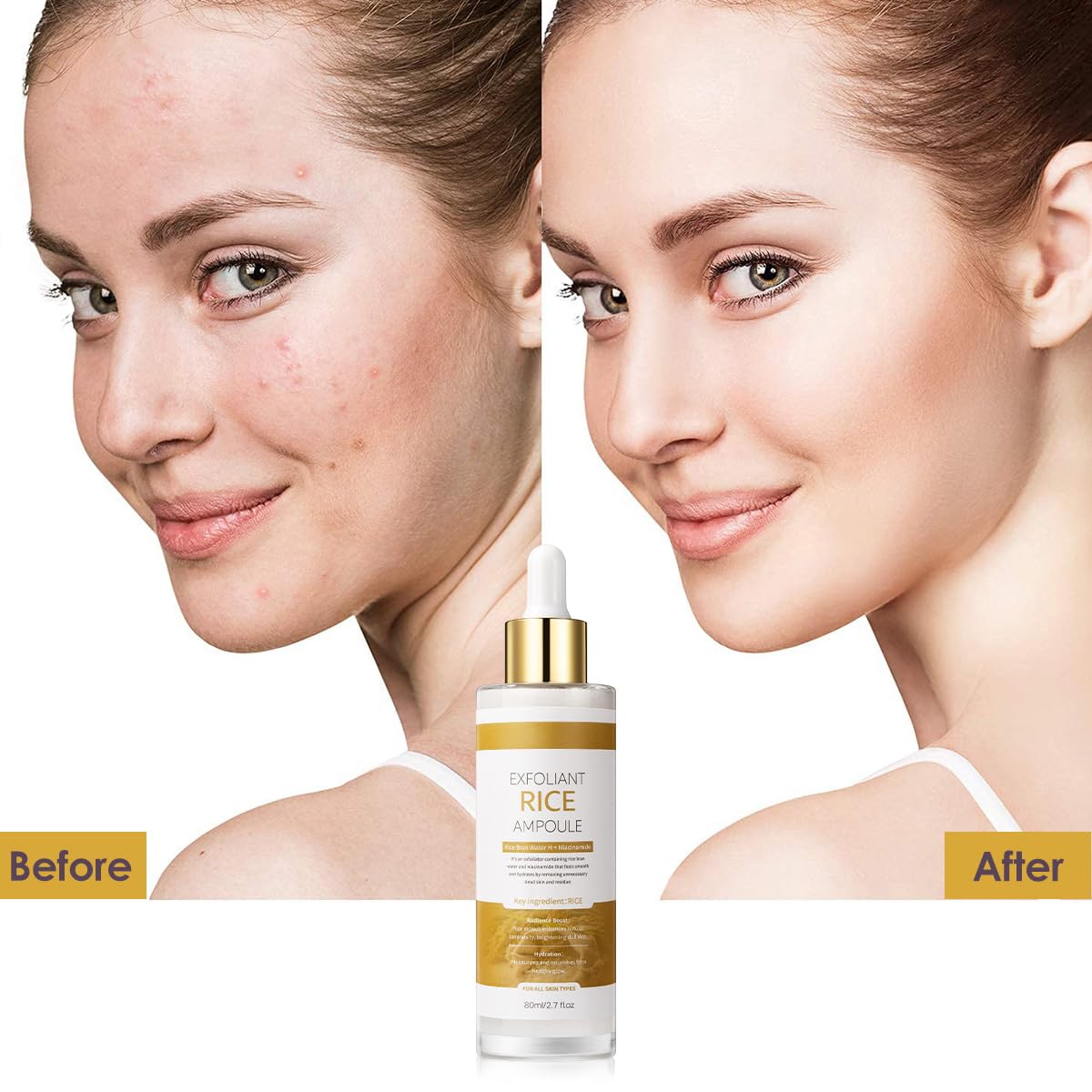 Natural Rice Exfoliating Serum - Gentle Brightening Ampoule for Radiant Skin - veakoo