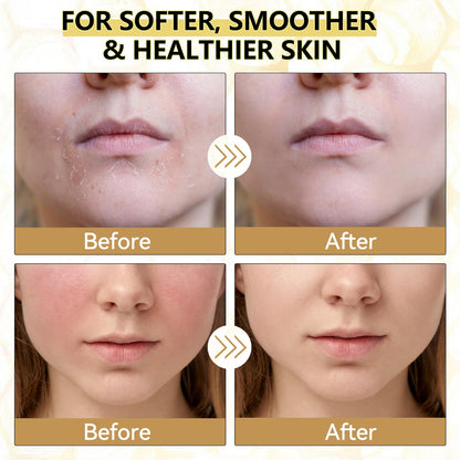 Grass-Fed Beef Tallow Body Balm with Honey - Natural Skin Moisturizer - veakoo