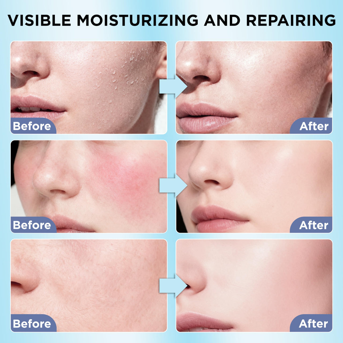 Grass-Fed Beef Tallow Face Cream - Natural Moisturizing Balm (3.5oz Tube) - veakoo