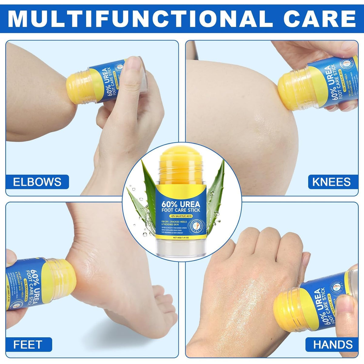 60% Urea Foot Cream Stick with 2% Salicylic Acid, 1.41 oz