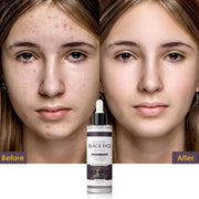 Peel Shot Glow Black Rice Exfoliant Peeling Ampoule(2.7fl.oz) - veakoo