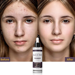 Peel Shot Glow Black Rice Exfoliant Peeling Ampoule(2.7fl.oz) - veakoo