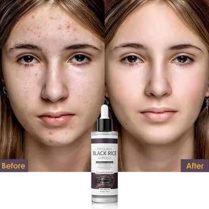 Peel Shot Glow Black Rice Exfoliant Peeling Ampoule(2.7fl.oz) - veakoo