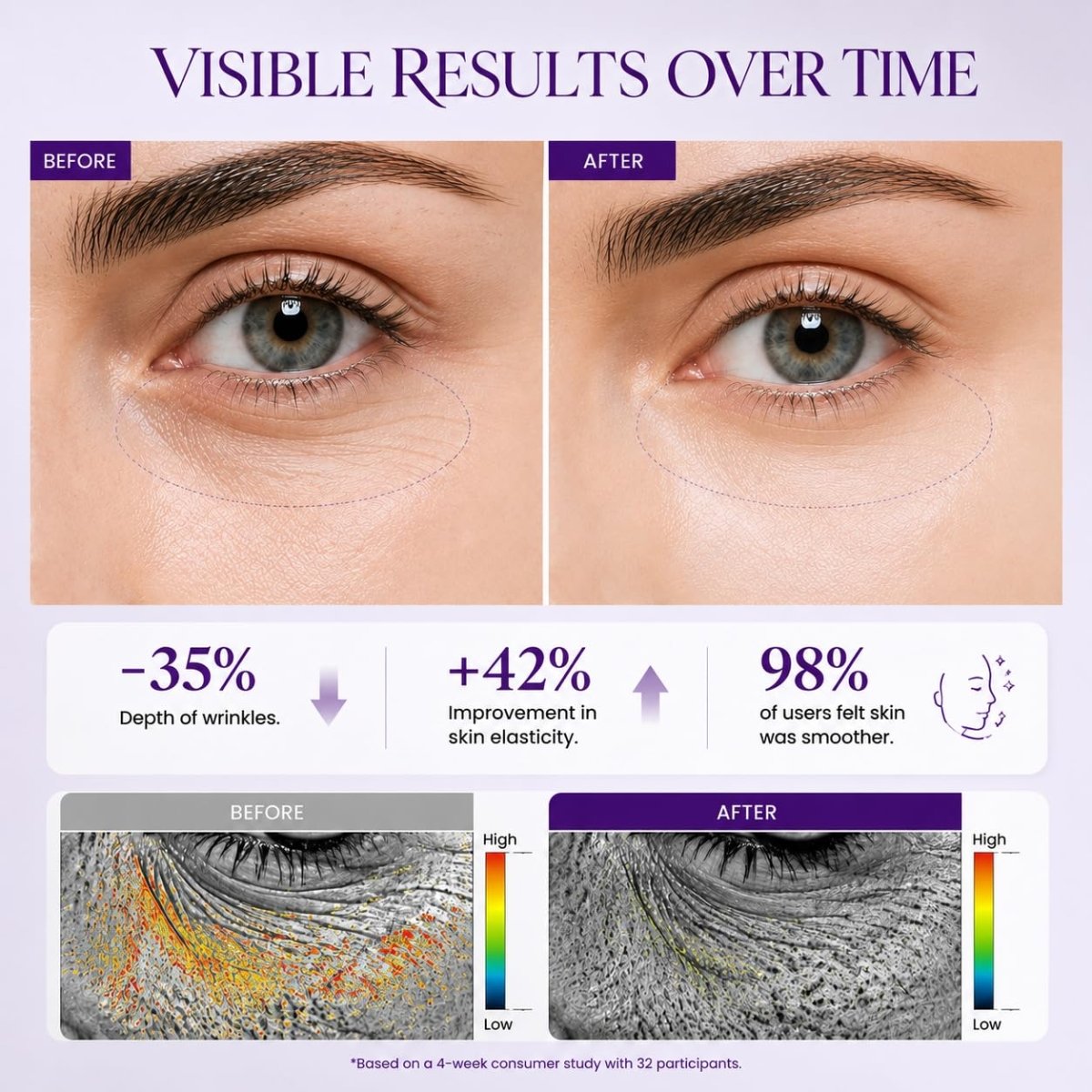 Retinol Eye Cream, Anti-Aging for Dark Circles and Puffiness, 1.06 oz - veakoo