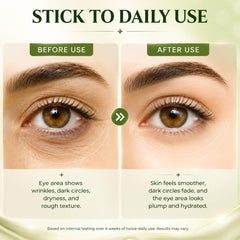 Retinol Eye Cream with PDRN and Peptides, Anti-Aging Under Eye Care, 1.06 oz - veakoo