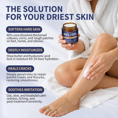 Urea Cream 40% for Feet, Salicylic Acid 2%, Callus Remover, 4.23 oz - veakoo